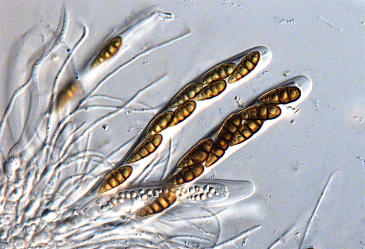 Sporesekker fra Lophiostoma clavatum, funnet på steinnype Rosa canina. Foto: Mathias Andreassen/Björn Nordén.